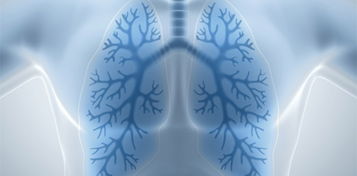Lung Cancer Screening Early Detection Saves Lives
