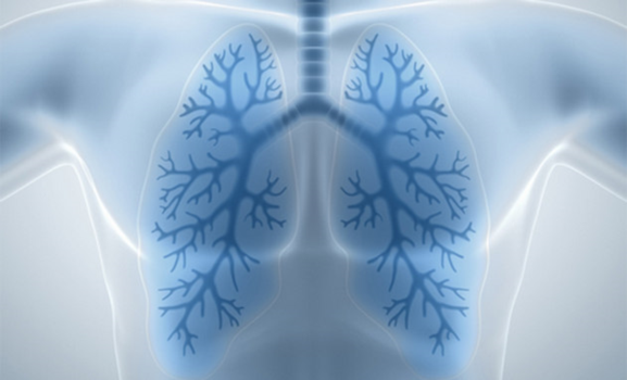 Akciğer Kanseri Tarama Programi ile Erken Teşhis Mümkün