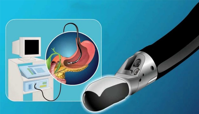 Endoskopik Ultrason (EUS) Hangi Rahatsızlıklarda Kullanılır?