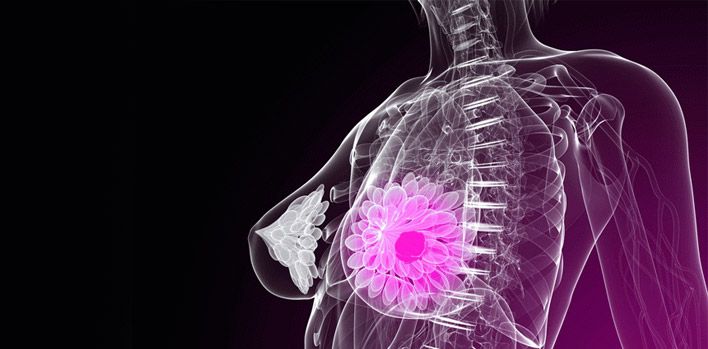Kontrastlı Mamografi ​Nedir?