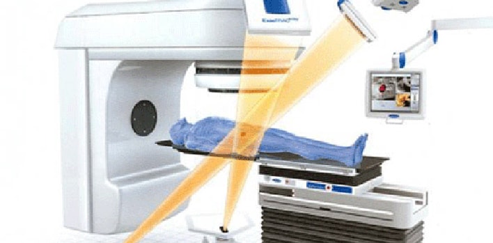 What is Radiotherapy? In which situations is it used?